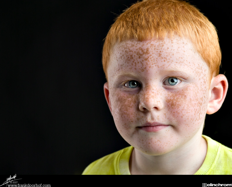 PhotoShop给满脸雀斑的小男孩磨皮教程1