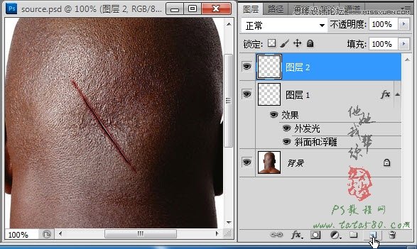 Photoshop合成人物缝合的伤口效果教程14