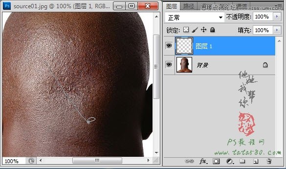 Photoshop合成人物缝合的伤口效果教程7