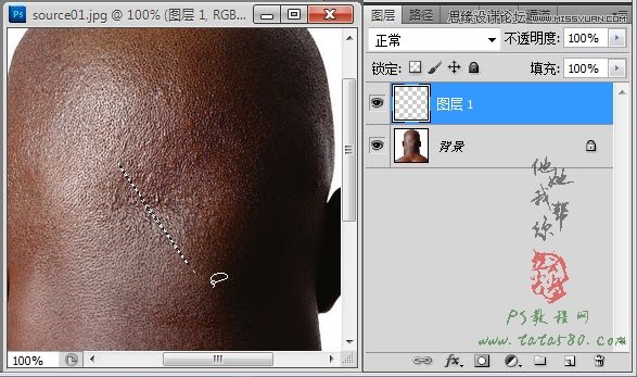 Photoshop合成人物缝合的伤口效果教程8