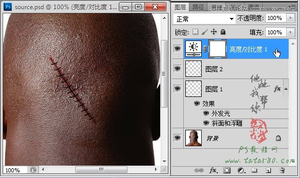 Photoshop合成人物缝合的伤口效果教程21