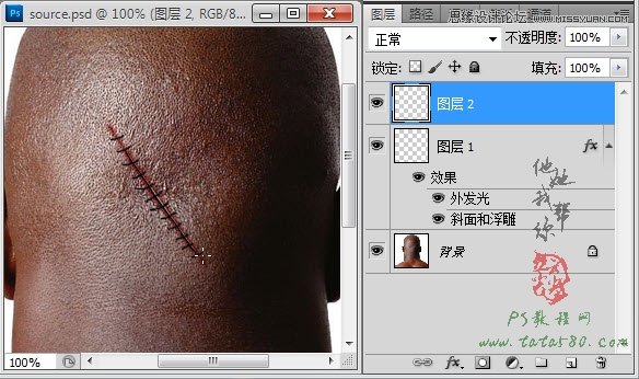 Photoshop合成人物缝合的伤口效果教程18