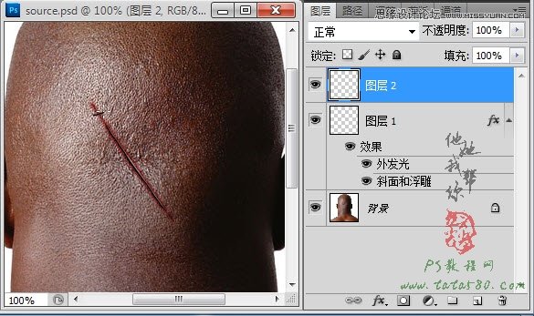 Photoshop合成人物缝合的伤口效果教程17
