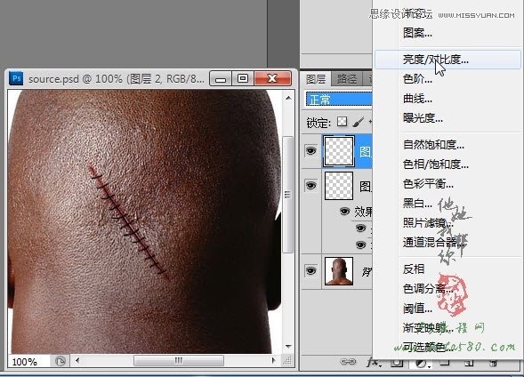 Photoshop合成人物缝合的伤口效果教程19