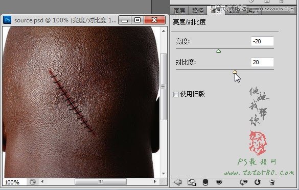 Photoshop合成人物缝合的伤口效果教程20
