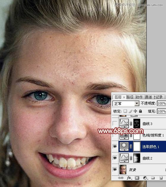 Photoshop怎么使用通道法给满脸雀斑的女人磨皮9