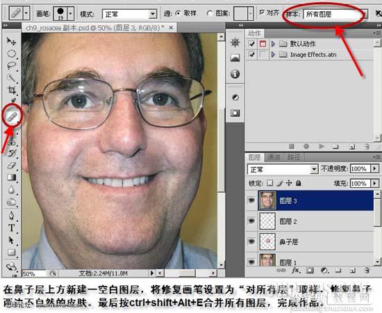 Photoshop 偏色多斑的中老年人图片修复20